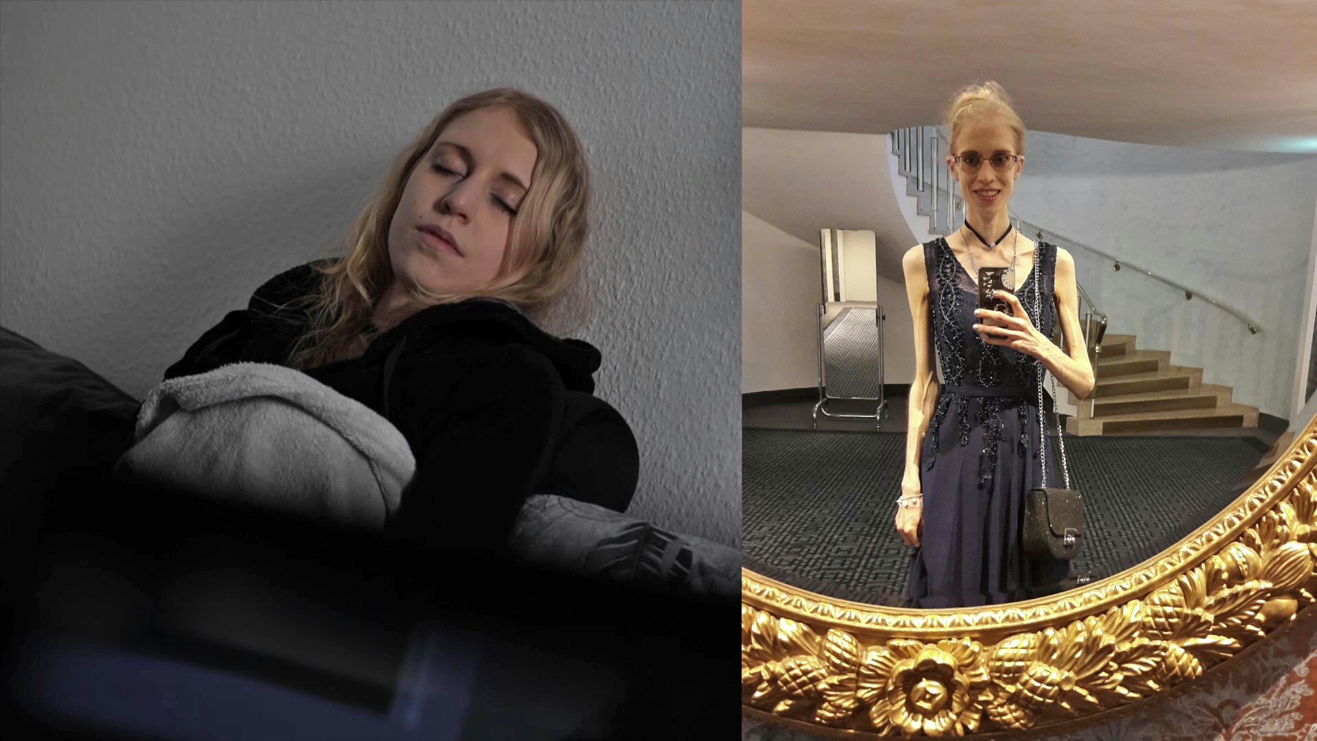 Zwischen Hunger und Hoffnung Ich war magersüchtig Bibel TV